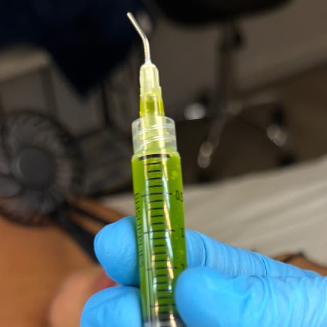 4 BioRepeels + Free Mini Facial at Stacey Carta Skin Care in Concord, CA